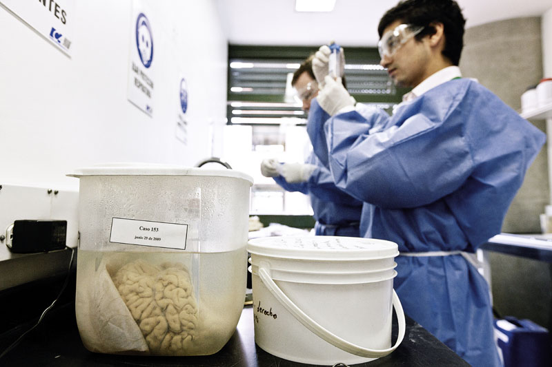 actualidad, alzheimer, alvaro ybarra zavala, xlsemanal