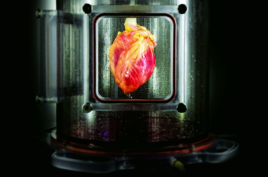 ¿Llega el trasplante de corazón sin donante?