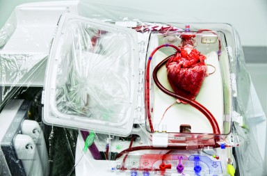 Los nuevos corazones portátiles