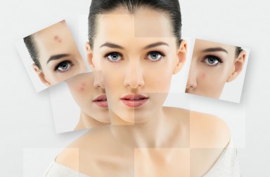 Nuevas técnicas de belleza