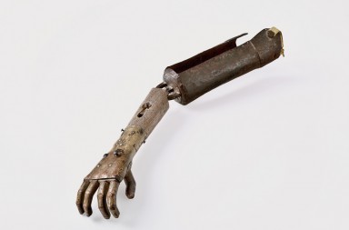 El primer brazo biónico