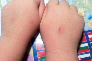 Cómo detectar si tu hijo está en webs o juegos autodestructivos