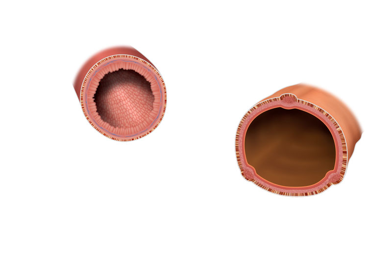 conocer, salud, flora intestinal, intestino, organo, xlsemanal