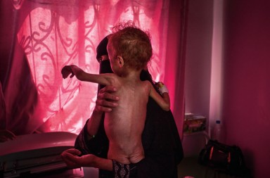 Yemen, las otras víctimas de Arabia Saudí