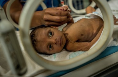 Venezuela, donde los niños mueren de hambre