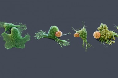 Vencer al cáncer desde dentro, cada día más cerca