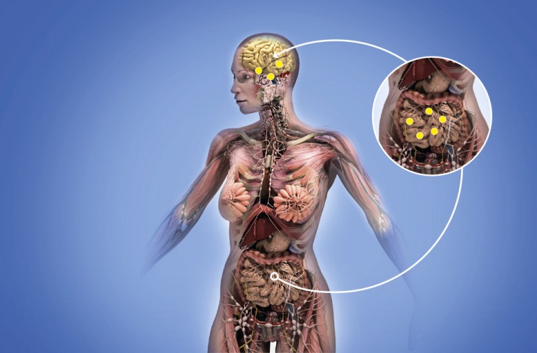El párkinson empieza en el intestino El párkinson empieza en el intestino