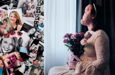 Trasplante de cara, una segunda oportunidad para Kate