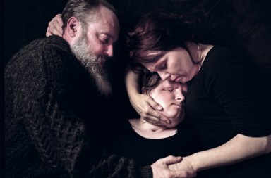 El duro proceso de un trasplante de cara