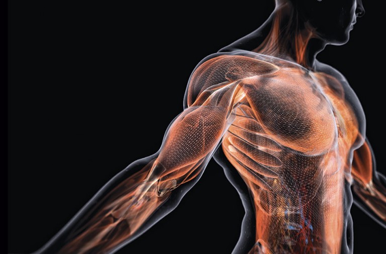 Crónico afecciones que muscular causan dolor