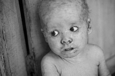 Argentina, la tierra de los niños envenenados