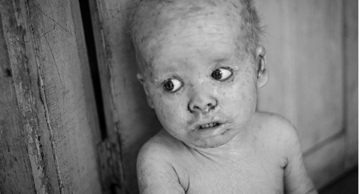 Argentina, la tierra de los niños envenenados