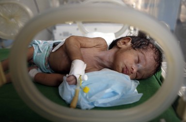 En Yemen los niños no tienen futuro