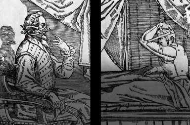 Cirugía estética: las operaciones más curiosas de la historia