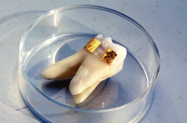 Lo último en tecnología para la salud