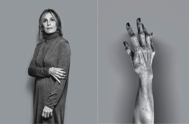 Artrosis: «Me da pavor que me estrechen la mano»