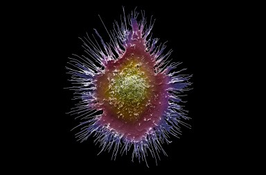 Coronavirus: cómo funciona el sistema inmune y cómo activarlo