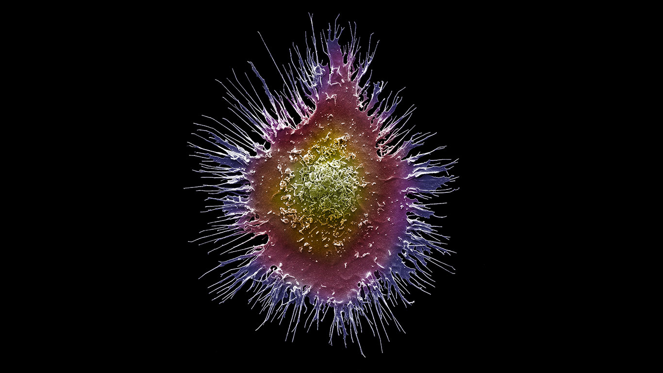 Coronavirus: cómo funciona el sistema inmune y cómo activarlo