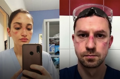 Marcas de guerra: los médicos y el coronavirus