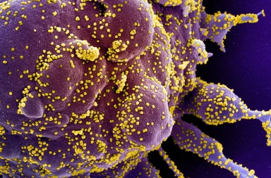 Fotografían al coronavirus: el verdadero rostro del asesino