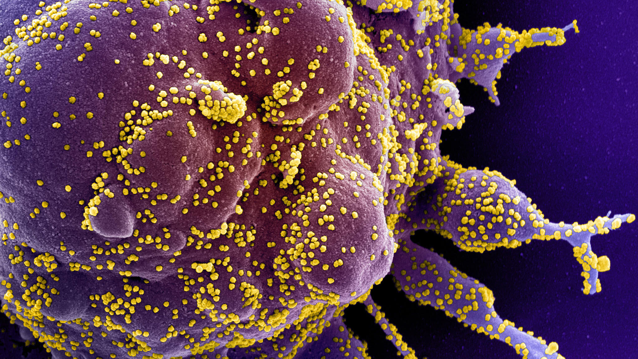Fotografían al coronavirus: el verdadero rostro del asesino