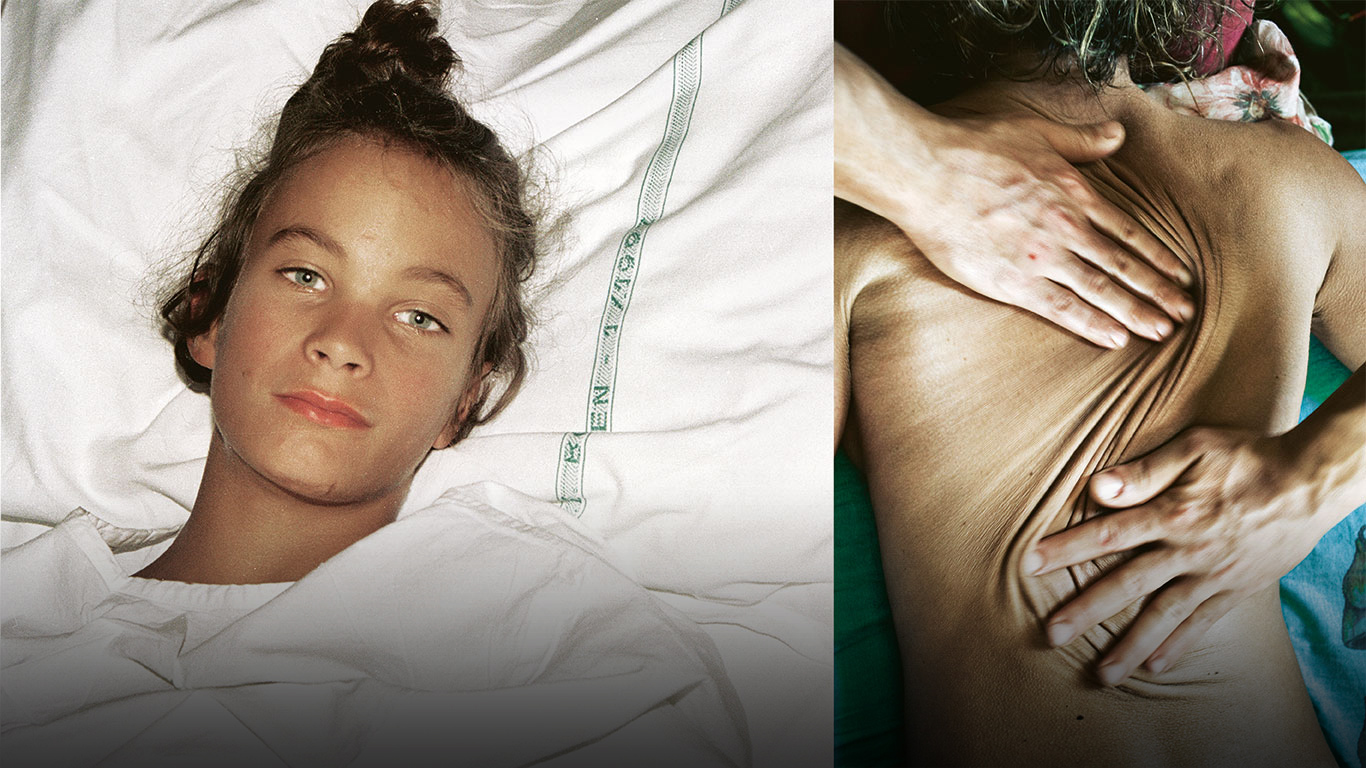 El desconcertante síndrome de Ehlers-Danlos: "Sé que el dolor nunca me