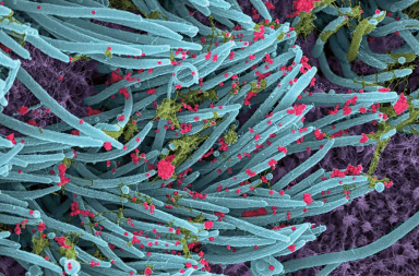 Covid-19: la foto de la batalla en los pulmones